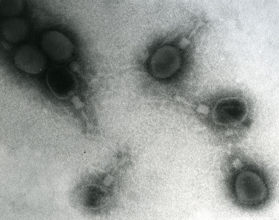 T4 bacteriophage